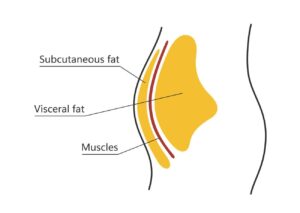 visceral fat vs subcutaneous fat